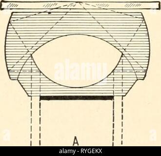 Chimici elementari elementarychemi microscopia00cham Anno: 1921 42 elementari microscopia chimica può essere la cui presenza sarà rivelata dal loro pattern di diffrazione. Quando il limite superiore di obliquità è raggiunto gli illuminatori sono generalmente indicati come ultracondensers e gli strumenti ai quali essi sono attaccati sono quindi noti come ultramicroscopes. Non vi è alcuna linea di separazione netta tra le comuni dark-massa e illuminazione ultramicroscopic illu- mination; l'uno si fonde gradualmente nell'altro. In tutti ultra- microscopi abbiamo a che fare con dark-massa illuminazione, ma, dall'altro h Foto Stock