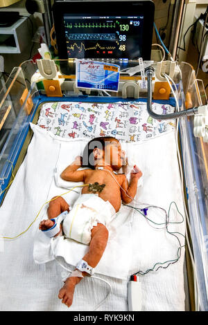 St Vincent de Paul ospedale, gestito dalle Figlie della Carità missionari cattolici a Nazareth, Israele. Neonatologia Ward. Bambino prematuro. Foto Stock