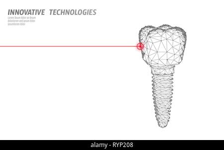 Dente impianto bassa poli concetto di medicina. Stomatologia innovazione tecnologia dentale modello di intestazione illutration vettore Illustrazione Vettoriale