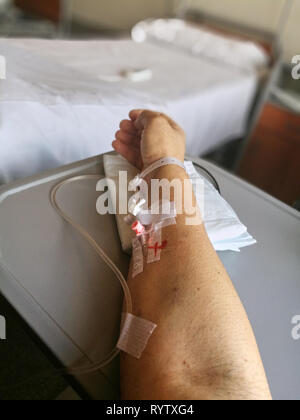 Primo piano di un braccio con periferiche catetere venoso Foto Stock