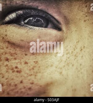 Freckled occhio sorridente. Chiudere la metà del volto del giovane ragazzo cheeky sorridente. Foto Stock