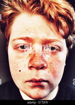 Ragazzo con lentiggini Foto Stock