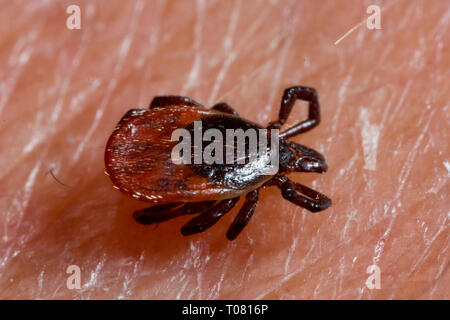 Castor bean tick, pelle umana, (Ixodes ricinus) Foto Stock