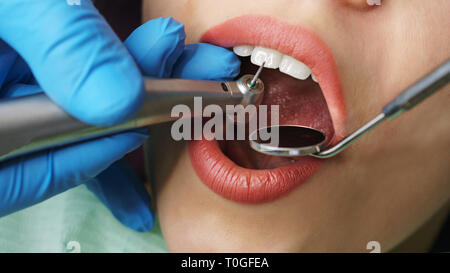 Dentista tratta la donna di denti. Ragazza giovane con la bocca aperta. Denti bianchi. Dentista mani con strumenti medicali. Close-up. Dental Clinic. Foto Stock