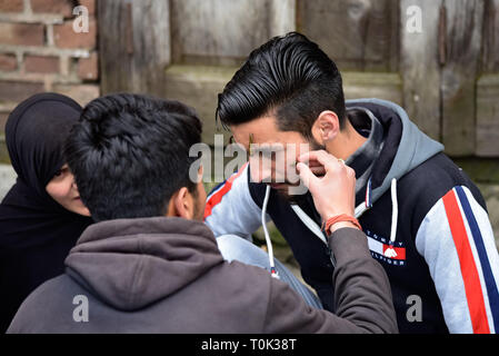 Marzo 21, 2019 - Srinagar, Jammu e Kashmir India - un paziente del Kashmir visto con le sanguisughe sul suo viso durante il trattamento di sanguisuga.un tradizionale lavoratore di salute utilizza le sanguisughe per succhiare il sangue impuro come parte di un trattamento a Hazratbal sulle rive del Dal lago nella periferia di Srinagar capitale estiva dell indiano Kashmir amministrato. Ogni anno tradizionali di operatori sanitari in Kashmir per utilizzare le sanguisughe per curare la gente per il prurito, dolorose dei grumi che si sviluppano sulla pelle chiamato chilblains acquisite durante l'inverno. Migliaia di pazienti che soffrono di vari problemi della pelle riceve leech trattamento a Hazratbal Foto Stock