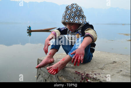 Marzo 21, 2019 - popolo del Kashmir prendere Leech trattamento sulle rive del Lago Dal Srinagar, Indiano Kashmir amministrato il 21 marzo 2019. Il trattamento tradizionale è tenuto ogni anno nel giorno di Nauroz (iraniane di Capodanno). I Guaritori utilizzano le sanguisughe per succhiare il sangue impuro dai pazienti che hanno la pelle, a freddo o gelo malattie. (Credito Immagine: © Muzamil Mattoo/IMAGESLIVE via ZUMA filo) Foto Stock