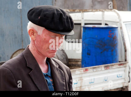 Ritratto di albino uomo Uyghur al mercato notevole domenica a Kashgar, Xinjiang Autonomous Region, Cina. Foto Stock