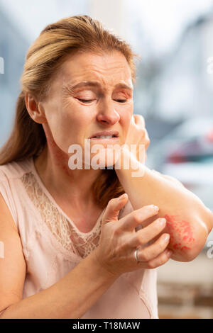 Biondo e sentimento donna ache sulla pelle che soffrono di allergia Foto Stock