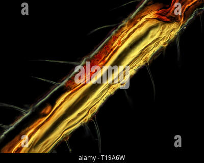 Campo scuro micrografia di luce di una gamba di afide, area raffigurato è di circa 243 micron ampia Foto Stock
