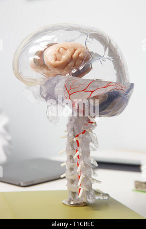 Modello 3D del cervello umano con il midollo spinale. La demenza e il morbo di Alzheimer, ictus cerebrale, malattia del cervello e concetto di anatomia. Foto Stock