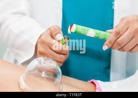 Medico di eseguire una terapia moxibustione su un giovane paziente di sesso femminile indietro Foto Stock