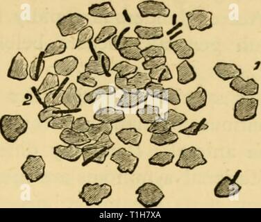 Le malattie e i disturbi di malattie e disturbi del cavallo : un trattato di medicina equina e chirurgia diseasesdisorder00gres Anno: 1886 13 Pus di un ascesso polmonare in un cavallo morto di morva. 1. I nuclei delle cellule di pus. 2. La morva-bacilli. Il potere di ingrandimento 700. (La preparazione sono state colorate con blu di metilene.) Dopo Klein. Foto Stock