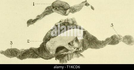 Le malattie dell'apparato genitale le malattie degli organi genitali degli animali domestici diseasesofgenita00sarà Anno: 1921 Fig. 221-necrotiche embrioni di suini. /, 2, Necrotic embrioni (membrane incisi per portarle in vista) j, un embrionale necrotico sac in cui l'embrione non può essere trovato ; 7, 5, feti sani dalla stessa utero. Fig. 222-necrotiche sani e di embrioni di suini dal medesimo utero. /, Embrione necrotico ; 2, embrioni sani; 3, suggerimenti necrotico. Foto Stock