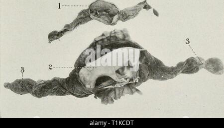 Le malattie dell'apparato genitale le malattie degli organi genitali degli animali domestici diseasesofgenita00willrich Anno: 1921 Fig. 221-necrotiche embrioni di suini. /, 2, Necrotic embrioni (membrane incisi per portarle in vista) J, un embrionale necrotico sac in cui l'embrione non può essere trovato ; 4, J, feti sani dalla stessa utero. Fig. 222-necrotiche sani e di embrioni di suini dalla stessa XJten /, embrione necrotico ; 2, embrioni sani; j', necrotic suggerimenti. Foto Stock