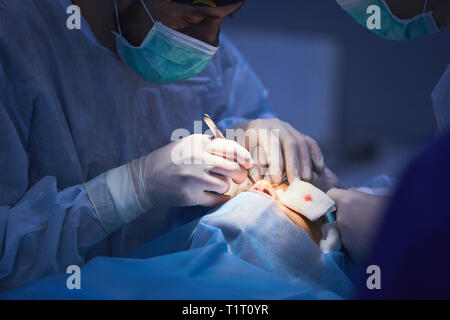 Il team chirurgico di eseguire la chirurgia nel moderno teatro di funzionamento,team di medici di concentrare su di un paziente durante un intervento chirurgico,team di medici lavorano Foto Stock