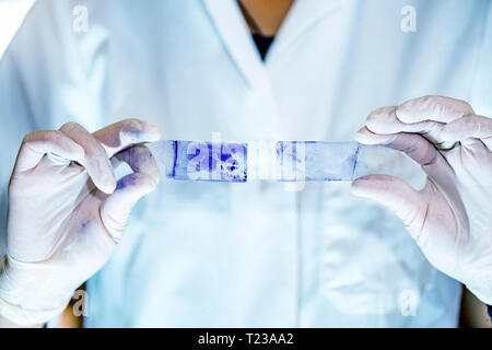 Laboratorio di microbiologia di lavoro, confrontando i risultati. Foto Stock
