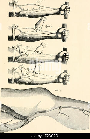 Archivio immagine dalla pagina 90 della scoperta della circolazione la scoperta della circolazione del sangue; da Charles Singer discoveryofcircu00cantare Anno: 1922 PIASTRA VII FIGG. 1-4. Esperimenti sul braccio bendato. Da Harvey. FIG. 5. La dissezione della vena in coscia e gamba per mostrare le valvole. Da Fabrizio, Foto Stock