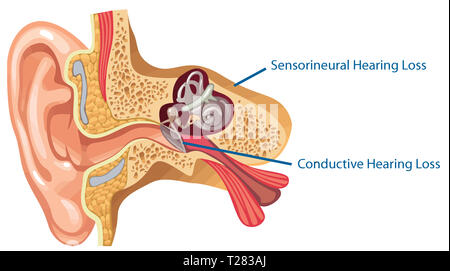 Anatomia dell'orecchio interno canal medico sensoriale del nervo suono illustrazione Foto Stock