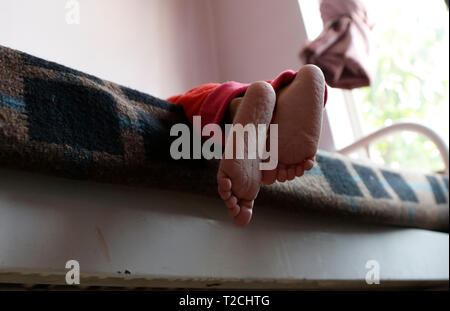 Sanaa, Yemen. 1 apr, 2019. I piedi di un bambino malnutriti sono visti a una malnutrizione care Center in Sanaa, Yemen, il 1 aprile 2019. Secondo il Fondo delle Nazioni Unite per l'Infanzia (UNICEF), circa 394,000 yemenita per i bambini sotto i 5 anni soffrono di malnutrizione severa acuta e necessità di trattamento. Credito: Mohammed Mohammed/Xinhua/Alamy Live News Foto Stock