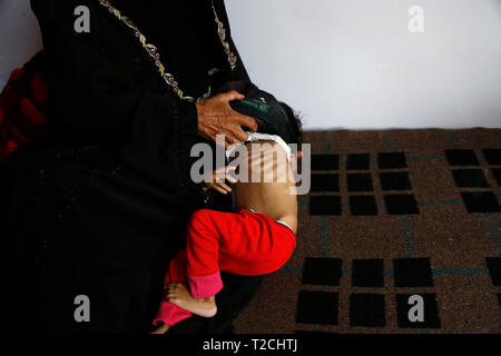 Sanaa, Yemen. 1 apr, 2019. Una donna mostra i suoi bambini malnutriti a una malnutrizione care Center in Sanaa, Yemen, il 1 aprile 2019. Secondo il Fondo delle Nazioni Unite per l'Infanzia (UNICEF), circa 394,000 yemenita per i bambini sotto i 5 anni soffrono di malnutrizione severa acuta e necessità di trattamento. Credito: Mohammed Mohammed/Xinhua/Alamy Live News Foto Stock