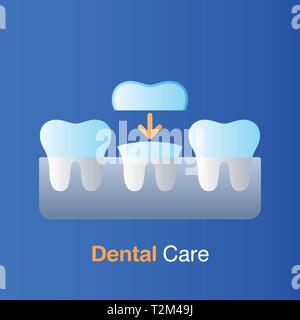 Per le cure dentarie concetto. Impianto odontoiatrico, prevenzione, check up e trattamento dentale. Illustrazione Vettoriale. Illustrazione Vettoriale