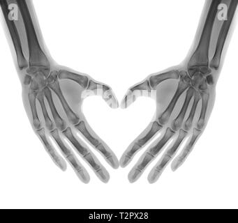 Negativa X-ray - umani palms piegato in una forma di cuore, isolato Foto Stock