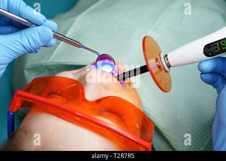 Moderno trattamento della carie nei bambini di odontoiatria. Dentista mette a tenuta piccola ragazza il suo bambino denti con il fotopolimero. Close-up Foto Stock