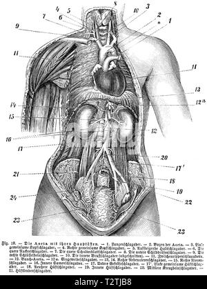 Umano: aorta con i suoi rami principali, 1) arteria polmonare, 2) Arco di aorta, 3) sinistro arteria carotide comune, 4)'arteria carotide comune destra, 5) ascendente arteria carotide, 6) trasversale arteria carotide, 7) trasversale scapola, 8) inferiore arteria della tiroide, 9 ) arteria coronaria destra, 10) interni di aorta toracica (troncato), 11) vene intercostali, 12) aorta addominale, 12 a) staph intestinale, 13, 14) di destra arteria surrenale, 15) destro arteria renale, 16) interni di vena seminale, 17) inferiore arteria mesenterica, 17 ') sinistra comune arteria hip, 18) esterna arteria hip, 19) interno hip arteria, 20) Mid-arteria sacrale, 21) Hip un Foto Stock