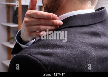 Close-up di un imprenditore forfora pulizia Off la spalla Foto Stock