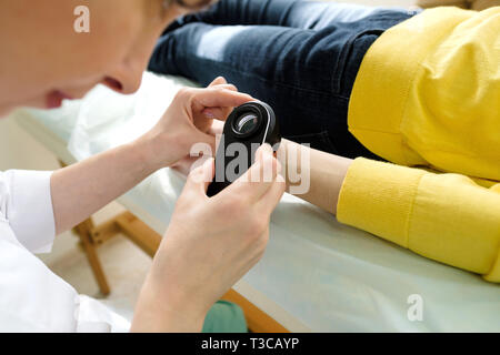 Il dermatologo femmina usando un professionista dermatoscope mentre si esegue un esame della pelle, controllo benigne moli sulla mano. Il dermatologo esaminando birthmarks Foto Stock