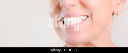 Caucasian donna matura con gli orecchini a cerchio che mostrano una perfetta bianco naturale dei denti sul lato Foto Stock