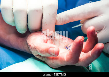 Chirurgo del bendaggio della mano di un paziente alla fine della chirurgia Foto Stock