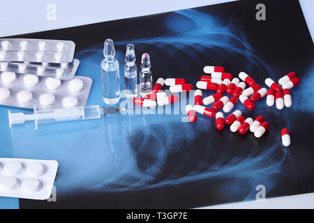 Sparse in capsule, compresse, fiale e la siringa sul tavolo con cardiogram grafico ecg (mi) e di Roentgen. Il concetto di assistenza sanitaria. Cardiogram stampa. Foto Stock