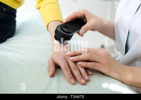 Il dermatologo femmina usando un professionista dermatoscope mentre si esegue un esame della pelle, controllo benigne moli sulla mano. Il dermatologo esaminando birthmarks Foto Stock