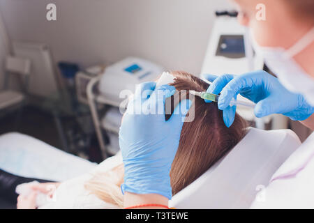 Il plasma ricco di piastrine procedura di iniezione. La crescita dei capelli stimolazione. La terapia con PRP processo. Foto Stock