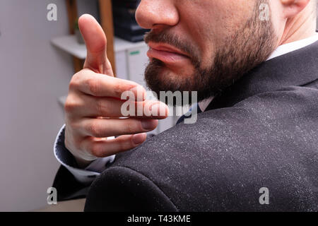 Close-up di un imprenditore forfora pulizia Off la spalla Foto Stock