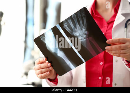 Radiologo femmina tenere in mano xray film Foto Stock