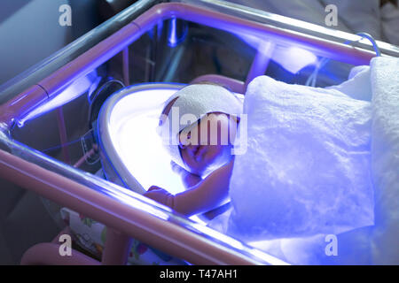 Il bambino si trova sotto una lampada a raggi ultravioletti con ittero Foto Stock