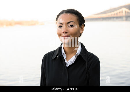 Una giovane e bella ragazza di etnia africana con la vitiligine in piedi sulla calda primavera città strada vestito mantello nero close up ritratto di donna con s Foto Stock