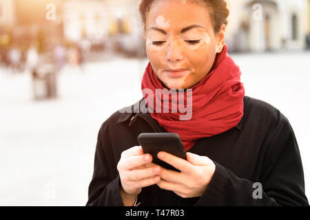 Una giovane e bella ragazza di etnia africana con la vitiligine in piedi sulla calda primavera via della città utilizzando il telefono cellulare close up ritratto di donna con s Foto Stock