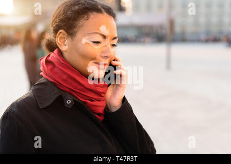 Una giovane e bella ragazza di etnia africana con la vitiligine in piedi sulla calda primavera via della città utilizzando il telefono cellulare close up ritratto di donna con s Foto Stock