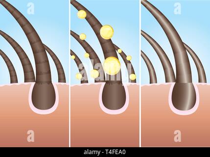 Illustrazione di tre fase di capelli cure, vettore Illustrazione Vettoriale