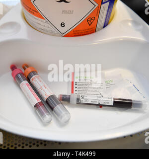 Flaconcini di sangue prelevato da un paziente in una clinica medica, in base all'Università di Bristol. Stampa foto di associazione. Picture Data: lunedì 8 aprile 2019. Foto di credito dovrebbe leggere: Ben Birchall Foto Stock