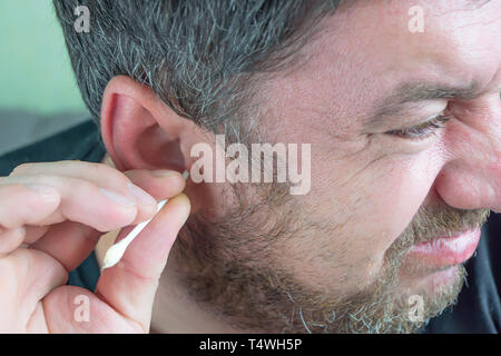 Un uomo con una barba pulisce le orecchie con un batuffolo di cotone per pulire Foto Stock