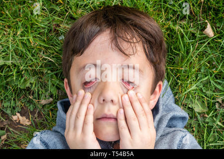 Un giovane ragazzo si stende su erba e tira il suo occhio inferiore coperchi verso il basso. Foto Stock