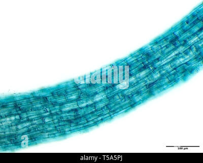 Campo luminoso di luce micrografia di una rapa seedling root (colorato) Foto Stock