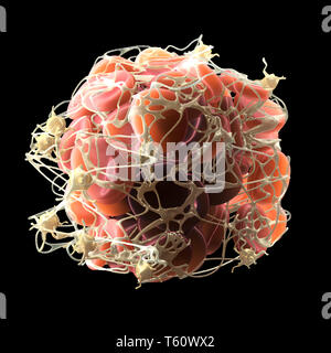 Trombo nel flusso sanguigno, coagulo di sangue con piastrine attivate e fibrina, medicalmente 3D'illustrazione su sfondo bianco Foto Stock