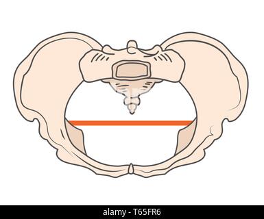 Platypoid / Platypelloid pelvi con forma rotonda o di forma circolare Illustrazione Vettoriale