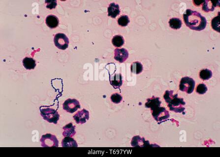 Questa è una microfotografia di una coltura di sangue campione, mostra numeri di Gram-positivi, a-emolitica streptococchi viridans gruppo batteri, la maggior parte dei quali sono stati disposti in due catene lunghe, 1978. Il streptococchi viridans gruppo di batteri è composto da un numero di specie streptococcica che sono sia un emolitico, o non emolitico. Immagine cortesia CDC/Dott. Mike Miller. Foto Stock