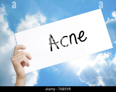 Segno di acne sul libro bianco. Man mano che tiene la carta con testo. Isolato su sfondo cielo Foto Stock